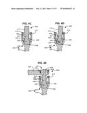 LOAD-SHARING BONE ANCHOR HAVING A DEFLECTABLE POST WITH A COMPLIANT RING AND METHOD FOR STABILIZATION OF THE SPINE diagram and image