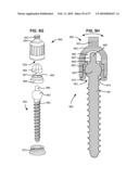 LOAD-SHARING BONE ANCHOR HAVING A DEFLECTABLE POST WITH A COMPLIANT RING AND METHOD FOR STABILIZATION OF THE SPINE diagram and image