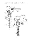 LOAD-SHARING BONE ANCHOR HAVING A DEFLECTABLE POST WITH A COMPLIANT RING AND METHOD FOR STABILIZATION OF THE SPINE diagram and image