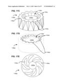 LOAD-SHARING BONE ANCHOR HAVING A DEFLECTABLE POST WITH A COMPLIANT RING AND METHOD FOR STABILIZATION OF THE SPINE diagram and image