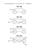 LOAD-SHARING BONE ANCHOR HAVING A DEFLECTABLE POST WITH A COMPLIANT RING AND METHOD FOR STABILIZATION OF THE SPINE diagram and image