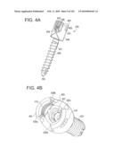 Systems and methods for spinal fixation diagram and image