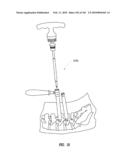 Systems and methods for spinal fixation diagram and image