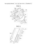 Systems and methods for spinal fixation diagram and image