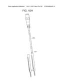 Systems and methods for spinal fixation diagram and image