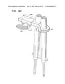 Systems and methods for spinal fixation diagram and image