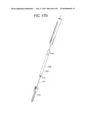 Systems and methods for spinal fixation diagram and image