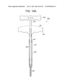 Systems and methods for spinal fixation diagram and image