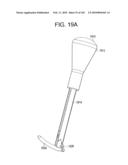 Systems and methods for spinal fixation diagram and image