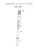 Systems and methods for spinal fixation diagram and image