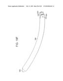 Systems and methods for spinal fixation diagram and image