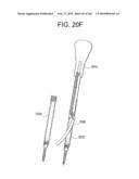 Systems and methods for spinal fixation diagram and image