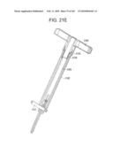 Systems and methods for spinal fixation diagram and image