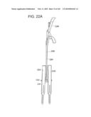 Systems and methods for spinal fixation diagram and image