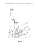 Systems and methods for spinal fixation diagram and image