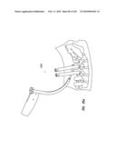 Systems and methods for spinal fixation diagram and image