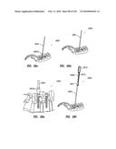 Systems and methods for spinal fixation diagram and image