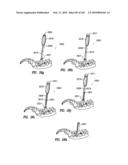 Systems and methods for spinal fixation diagram and image