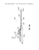 Systems and methods for spinal fixation diagram and image