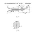 Methods for electrosurgical electrolysis diagram and image