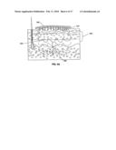 Methods for electrosurgical electrolysis diagram and image