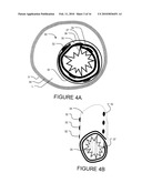 TRANSVASCULAR NERVE STIMULATION APPARATUS AND METHODS diagram and image