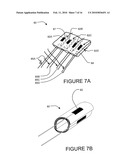 TRANSVASCULAR NERVE STIMULATION APPARATUS AND METHODS diagram and image