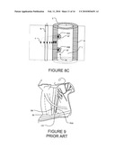 TRANSVASCULAR NERVE STIMULATION APPARATUS AND METHODS diagram and image