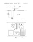 Systems and methods to place one or more leads in muscle for providing electrical stimulation to treat pain diagram and image