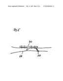 STIMULATION DEVICE FOR OSTEOSYNTHESIS AND ENDOPROSTHETICS diagram and image