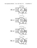 DELIVERY SYSTEM WITH VARIABLE DELIVERY RATE FOR DEPLOYING A MEDICAL DEVICE diagram and image