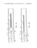 METHOD AND ASSEMBLY FOR DISTAL EMBOLIC PROTECTION diagram and image