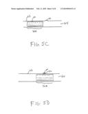 METHOD AND ASSEMBLY FOR DISTAL EMBOLIC PROTECTION diagram and image