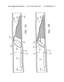 METHOD AND ASSEMBLY FOR DISTAL EMBOLIC PROTECTION diagram and image