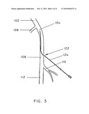 METHODS AND APPARATUS FOR EXTRALUMINAL FEMOROPOPLITEAL BYPASS GRAFT diagram and image