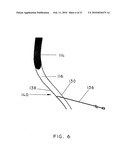 METHODS AND APPARATUS FOR EXTRALUMINAL FEMOROPOPLITEAL BYPASS GRAFT diagram and image