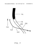 METHODS AND APPARATUS FOR EXTRALUMINAL FEMOROPOPLITEAL BYPASS GRAFT diagram and image