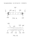 METHODS AND APPARATUS FOR EXTRALUMINAL FEMOROPOPLITEAL BYPASS GRAFT diagram and image