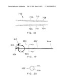 METHODS AND APPARATUS FOR EXTRALUMINAL FEMOROPOPLITEAL BYPASS GRAFT diagram and image