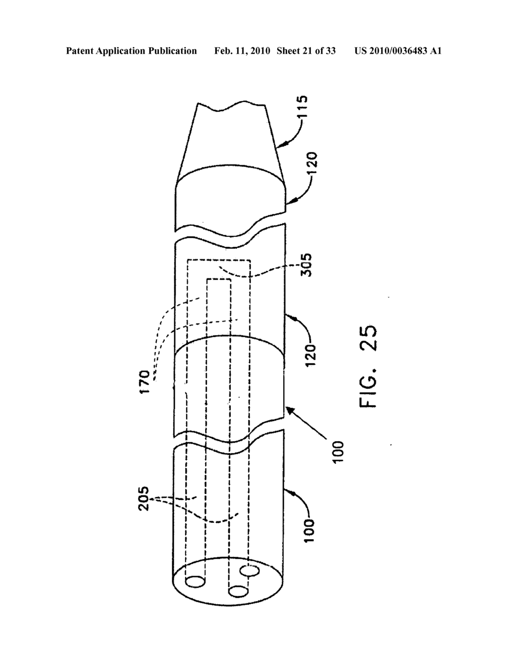 Method and apparatus for improving mitral valve function - diagram, schematic, and image 22