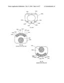 INTERVERTEBRAL SPACER DEVICE HAVING AN ENGAGEMENT HOLE FOR A TOOL WITH AN EXTENDABLE POST diagram and image