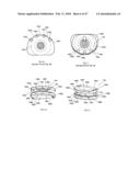 INTERVERTEBRAL SPACER DEVICE HAVING AN ENGAGEMENT HOLE FOR A TOOL WITH AN EXTENDABLE POST diagram and image