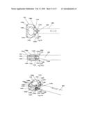 INTERVERTEBRAL SPACER DEVICE HAVING AN ENGAGEMENT HOLE FOR A TOOL WITH AN EXTENDABLE POST diagram and image