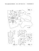 Device and method for treating spine diagram and image