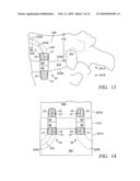 Device and method for treating spine diagram and image