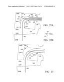 Device and method for treating spine diagram and image