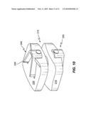 V-Shaped Staple for Spinal Prosthesis diagram and image