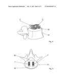 TOTAL DISC REPLACEMENT DEVICE diagram and image