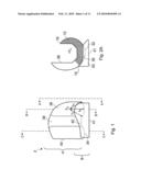 KNEE PROSTHESIS diagram and image