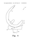 ORTHOPAEDIC KNEE PROSTHESIS HAVING CONTROLLED CONDYLAR CURVATURE diagram and image